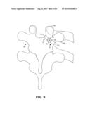 ROD-RECEIVING SPINAL FUSION ATTACHMENT ELEMENTS diagram and image