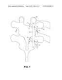 ROD-RECEIVING SPINAL FUSION ATTACHMENT ELEMENTS diagram and image