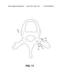 ROD-RECEIVING SPINAL FUSION ATTACHMENT ELEMENTS diagram and image