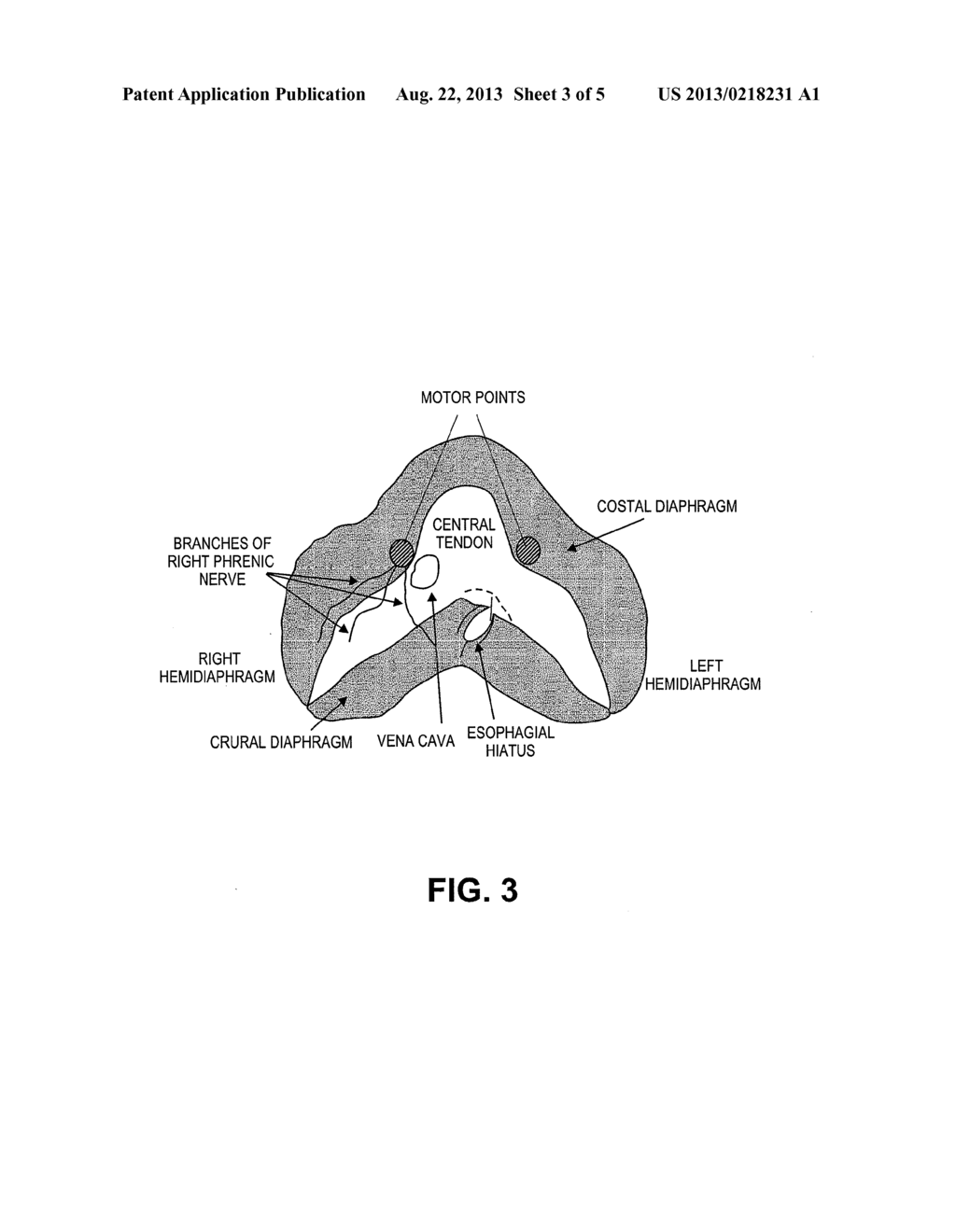 SYSTEM AND METHOD FOR CONDITIONING A DIAPHRAGM OF A PATIENT - diagram, schematic, and image 04