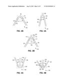 Medical Device with Regioselective Structure-Property Distribution diagram and image