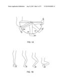 SYSTEMS AND METHODS FOR PROVIDING AN ASYMMETRICAL TIBIAL COMPONENT diagram and image