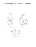 SYSTEMS AND METHODS FOR PROVIDING AN ASYMMETRICAL TIBIAL COMPONENT diagram and image