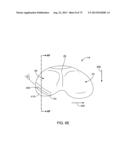 SYSTEMS AND METHODS FOR PROVIDING AN ASYMMETRICAL TIBIAL COMPONENT diagram and image