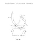 SYSTEMS AND METHODS FOR PROVIDING AN ASYMMETRICAL TIBIAL COMPONENT diagram and image