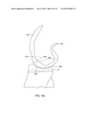 SYSTEMS AND METHODS FOR PROVIDING AN ASYMMETRICAL TIBIAL COMPONENT diagram and image