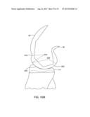 SYSTEMS AND METHODS FOR PROVIDING AN ASYMMETRICAL TIBIAL COMPONENT diagram and image