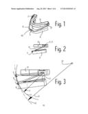 Oral Device for Improvement of Breathing diagram and image