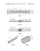 Expandable Tubing Run Through Production Tubing and Into Open Hole diagram and image