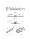 Enhanced Expandable Tubing Run Through Production Tubing and Into Open     Hole diagram and image