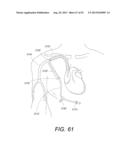 Portable Dialysis Machine with Improved Reservoir Heating System diagram and image