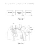 Portable Dialysis Machine with Improved Reservoir Heating System diagram and image