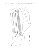 RELEASABLE TISSUE THICKNESS COMPENSATOR AND FASTENER CARTRIDGE HAVING THE     SAME diagram and image