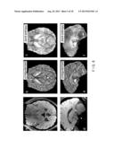 System, Process and Computer-Accessible Medium For Providing Quantitative     Susceptibility Mapping diagram and image