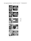 System, Process and Computer-Accessible Medium For Providing Quantitative     Susceptibility Mapping diagram and image