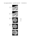 System, Process and Computer-Accessible Medium For Providing Quantitative     Susceptibility Mapping diagram and image