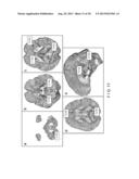 System, Process and Computer-Accessible Medium For Providing Quantitative     Susceptibility Mapping diagram and image