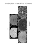 System, Process and Computer-Accessible Medium For Providing Quantitative     Susceptibility Mapping diagram and image