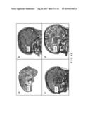 System, Process and Computer-Accessible Medium For Providing Quantitative     Susceptibility Mapping diagram and image