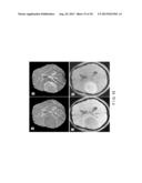 System, Process and Computer-Accessible Medium For Providing Quantitative     Susceptibility Mapping diagram and image