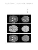 System, Process and Computer-Accessible Medium For Providing Quantitative     Susceptibility Mapping diagram and image