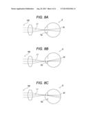 METHOD FOR TAKING TOMOGRAPHIC IMAGE OF EYE diagram and image