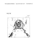 MEDICAL IMAGE PROCESSING APPARATUS diagram and image