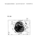 MEDICAL IMAGE PROCESSING APPARATUS diagram and image