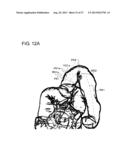 MEDICAL IMAGE PROCESSING APPARATUS diagram and image