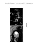 METHOD FOR CLASSIFYING A MULTITUDE OF IMAGES RECORDED BY A CAMERA     OBSERVING A PROCESSING AREA AND LASER MATERIAL PROCESSING HEAD USING THE     SAME diagram and image