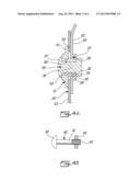 THERMAL EXPANSION JOINT CONNECTION FOR SHEET METAL ASSEMBLY diagram and image