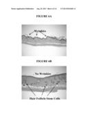 TOPICAL DELIVERY OF HORMONAL AND NON HORMONAL NANO FORMULATIONS, METHODS     OF MAKING AND USING THE SAME diagram and image