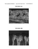 TOPICAL DELIVERY OF HORMONAL AND NON HORMONAL NANO FORMULATIONS, METHODS     OF MAKING AND USING THE SAME diagram and image