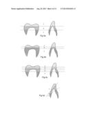 Non-Pre-Colored Multi-Layer Zirconia Dental Blank that has a Gradual     Change in Chroma through a Thickness After Sintering diagram and image