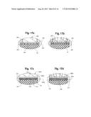 MEDICAL FLUID ACCESS DEVICE WITH ANTISEPTIC INDICATOR diagram and image