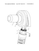 Quick-Connect Outflow Tube for Ventricular Assist Device diagram and image