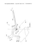 SYSTEMS, DEVICES AND METHODS FOR TREATING PELVIC FLOOR DISORDERS diagram and image