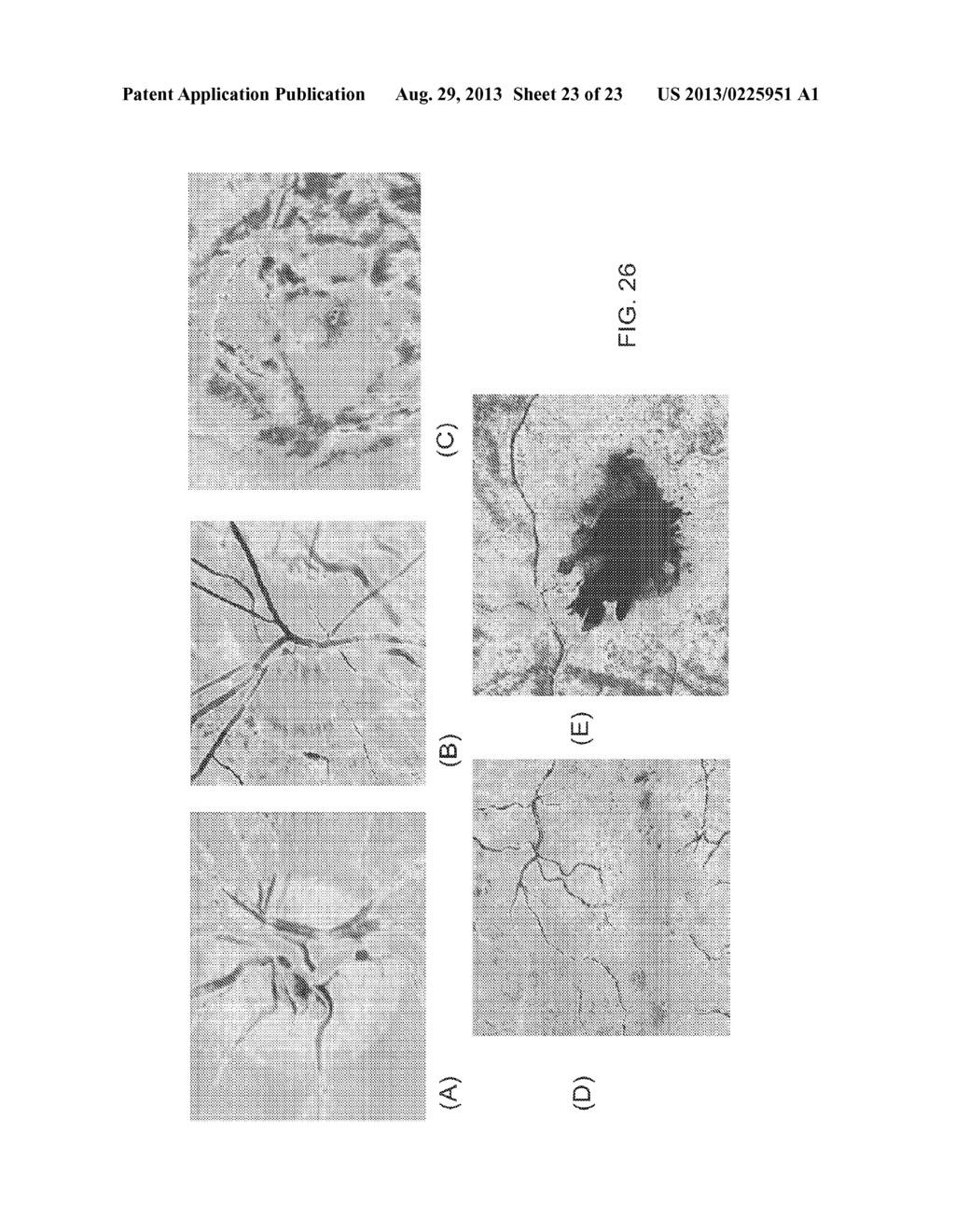 DETERMINATION OF OXYGEN SATURATION IN A TISSUE OF VISUAL SYSTEM - diagram, schematic, and image 24