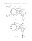 METHODS AND DEVICES TO MODULATE THE AUTONOMIC NERVOUS SYSTEM WITH     ULTRASOUND diagram and image