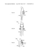 METHODS AND DEVICES TO MODULATE THE AUTONOMIC NERVOUS SYSTEM WITH     ULTRASOUND diagram and image