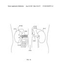 METHODS AND DEVICES TO MODULATE THE AUTONOMIC NERVOUS SYSTEM WITH     ULTRASOUND diagram and image