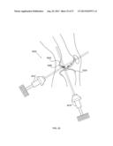 METHODS AND DEVICES TO MODULATE THE AUTONOMIC NERVOUS SYSTEM WITH     ULTRASOUND diagram and image