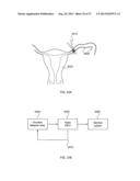 METHODS AND DEVICES TO MODULATE THE AUTONOMIC NERVOUS SYSTEM WITH     ULTRASOUND diagram and image