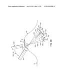 METHOD, APPARATUS AND SYSTEM FOR COMPLETE EXAMINATION OF TISSUE WITH     HAND-HELD IMAGING DEVICES diagram and image