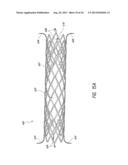 PULMONARY NODULE ACCESS DEVICES AND METHODS OF USING THE SAME diagram and image