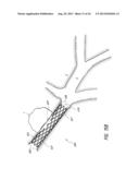 PULMONARY NODULE ACCESS DEVICES AND METHODS OF USING THE SAME diagram and image