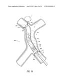 PULMONARY NODULE ACCESS DEVICES AND METHODS OF USING THE SAME diagram and image