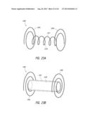 PULMONARY NODULE ACCESS DEVICES AND METHODS OF USING THE SAME diagram and image