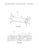 PULMONARY NODULE ACCESS DEVICES AND METHODS OF USING THE SAME diagram and image