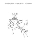 INTRAVASCULAR GUIDEWIRE diagram and image